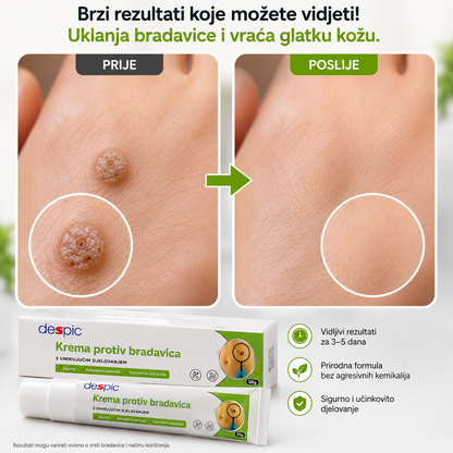 Cream Wart Remover (1+1) - Prirodno rješenje za brzo i učinkovito uklanjanje bradavica